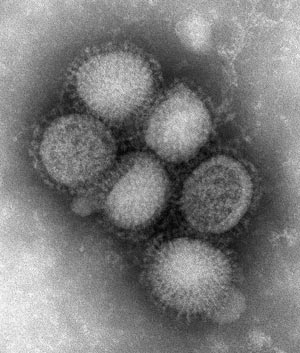 An electron microscope image shows an H1N1 swine flu virus culture obtained from a California patient suffering from the current international outbreak. (U.S. Centres for Disease Control)