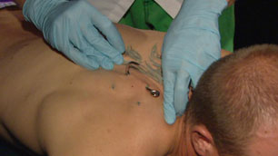 Hooks are inserted into the skin of the upper back of Dustin Detrisor. 
