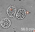 File:S3-Alveolar Macrophages with Conidia in Liquid Medium.ogg