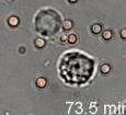 File:S4-J774 Cells with Conidia in Liquid Media.ogg