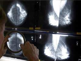 A new report raises fresh questions about the value of mammograms. The rate of cancers that have already spread far beyond the breast when they are discovered has stayed stable for decades, suggesting that screening and early detection are not preventing the most dangerous forms of the disease.