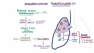 File:Tuberculosis video.webm