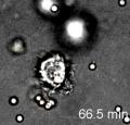 File:S6-Dendritic Cells with Conidia in Collagen.ogg
