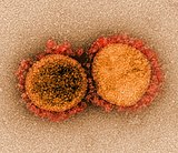 False-coloured electron micrograph of novel coronavirus