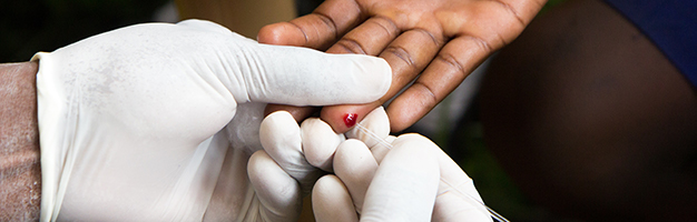  HIV testing,  Adam Jan Figel/ Shutterstock