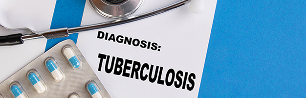 Diagnosis Tuberculosis written on medical blue folder, Marco Verch
