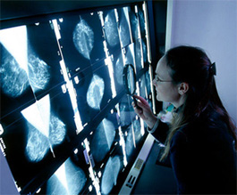 Radiologist studying mammograms - Copyright: Science Photo Library
