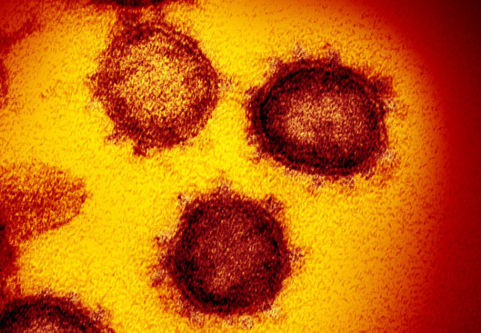 Novel Coronavirus SARS-CoV-2 (Credit: NIAID)
