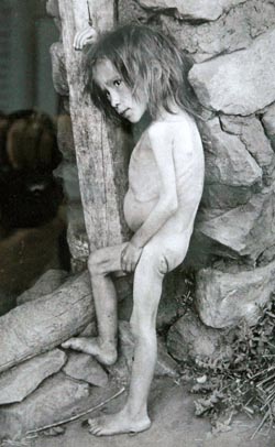 Girl affected by famine in Buguruslan, Russia - 1921.jpg