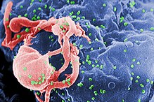 Small green orbs of HIV around a pink and blue cell